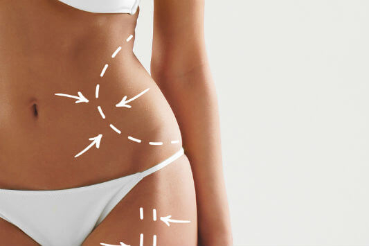 Advantages of Non-Surgical Body Sculpting Blog Post Featured Image