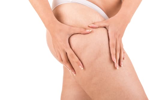 How Long Does QWO Cellulite Treatment Last? Blog Post Featured Image
