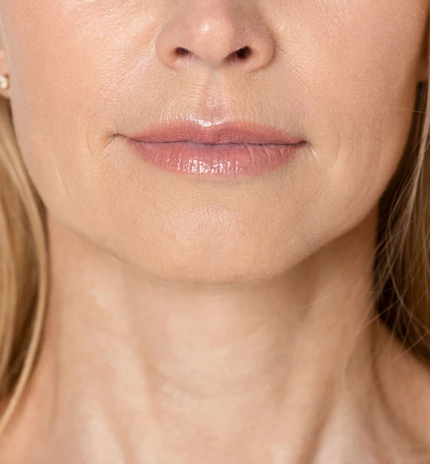 Closeup of woman's mouth and nose area